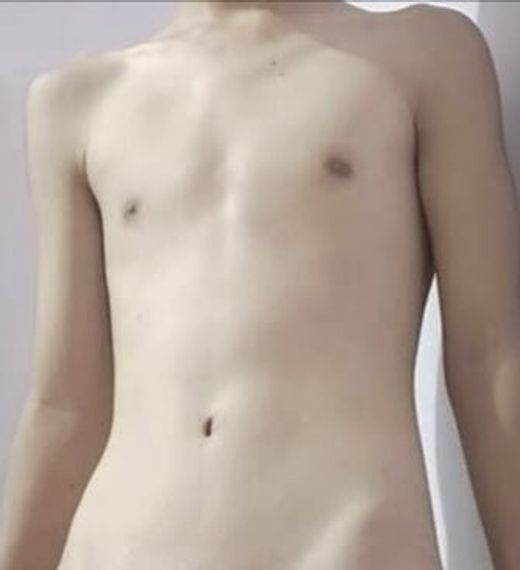 แชท แชทเปิดกล้อง 