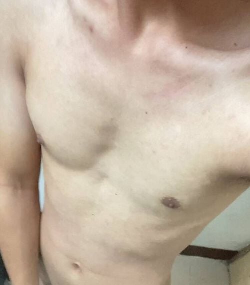 แชท แชทเปิดกล้อง