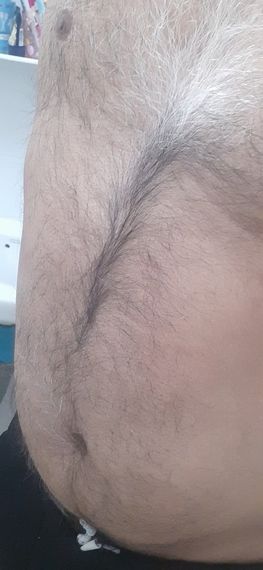 แชท หากิ๊ก, แชทเปิดกล้อง 