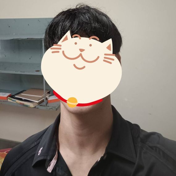 แชท หากิ๊ก 