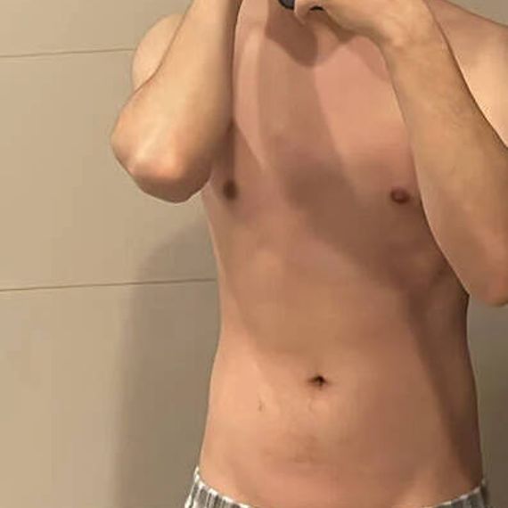 แชท หากิ๊ก 