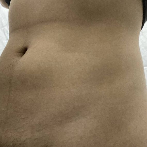 แชท หาเพื่อนคุย, หากิ๊ก 