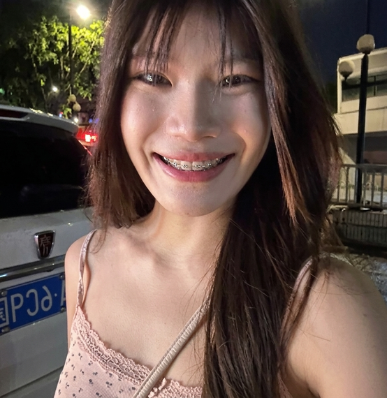 แชท หากิ๊ก 