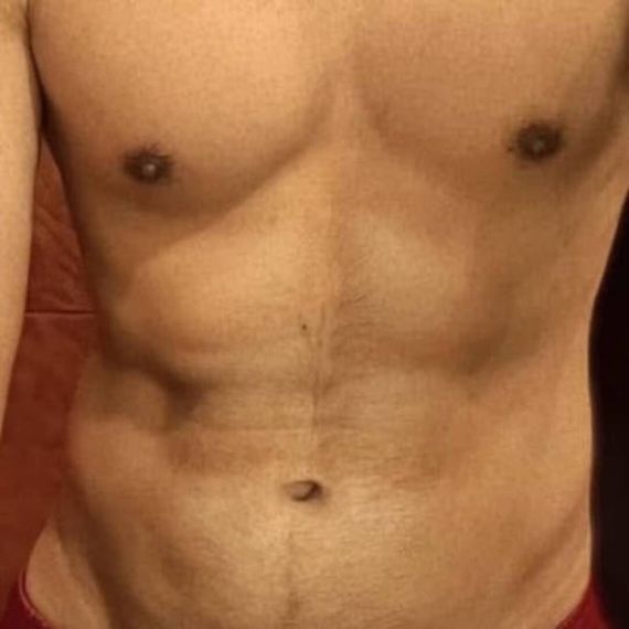 แชท หากิ๊ก 