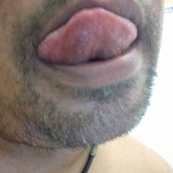 แชท หากิ๊ก 