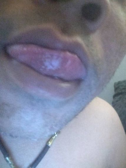 แชท หากิ๊ก 