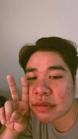 แชท โสด 