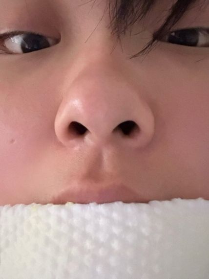 แชท แชทสด