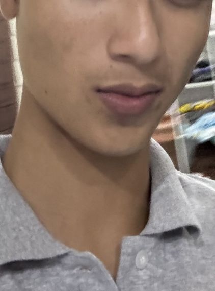 แชท หากิ๊ก 