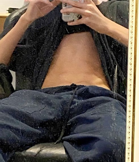 แชท หากิ๊ก 