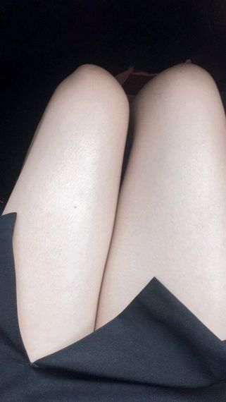 แชท หากิ๊ก 