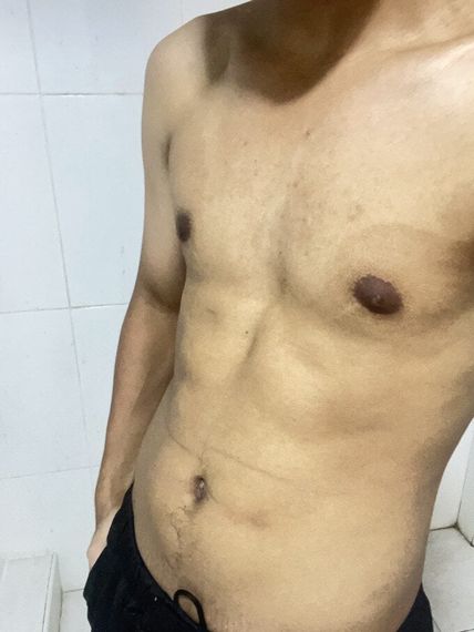 แชท หาเพื่อนคุย, โสด 