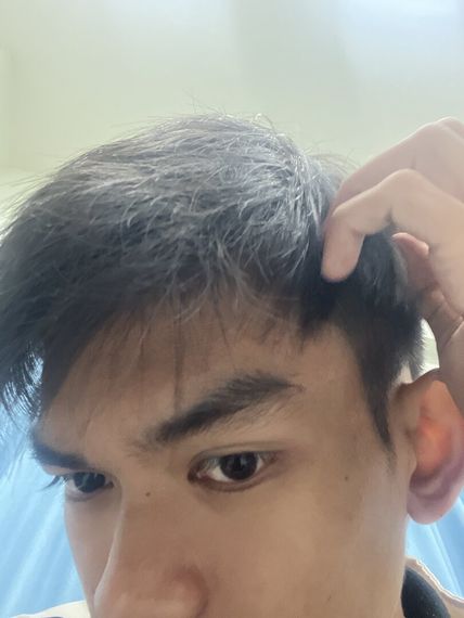 แชท หากิ๊ก 